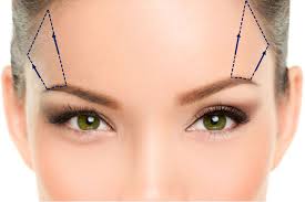 Eyebrow Lift